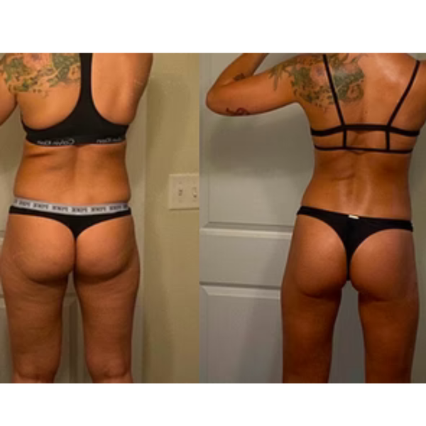 Sandra, 48
