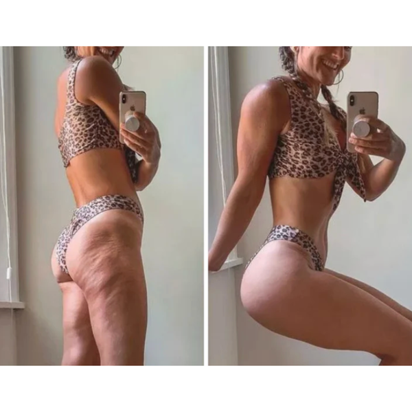 Laura, 36